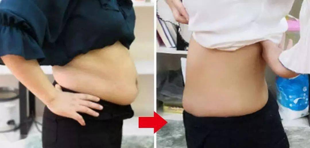 日本|日本黑科技泡脚汤药,竟让全民女人1个月瘦20斤!暴汗排湿还嫩肤助眠!