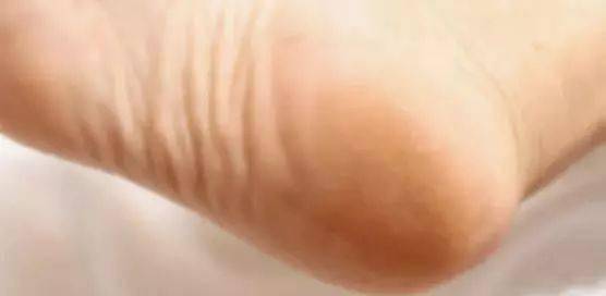 日本|日本黑科技泡脚汤药,竟让全民女人1个月瘦20斤!暴汗排湿还嫩肤助眠!