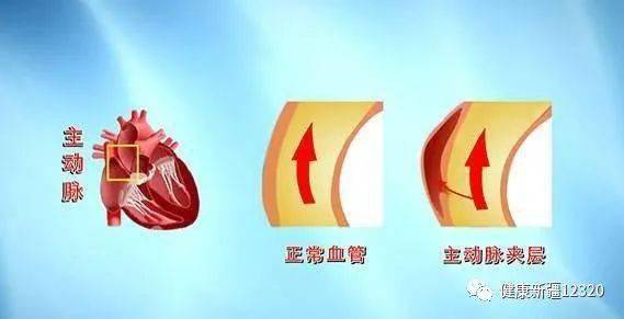 上线|健康中国行动专网正式上线 | 人体最痛的6种病,你经历过哪一个......
