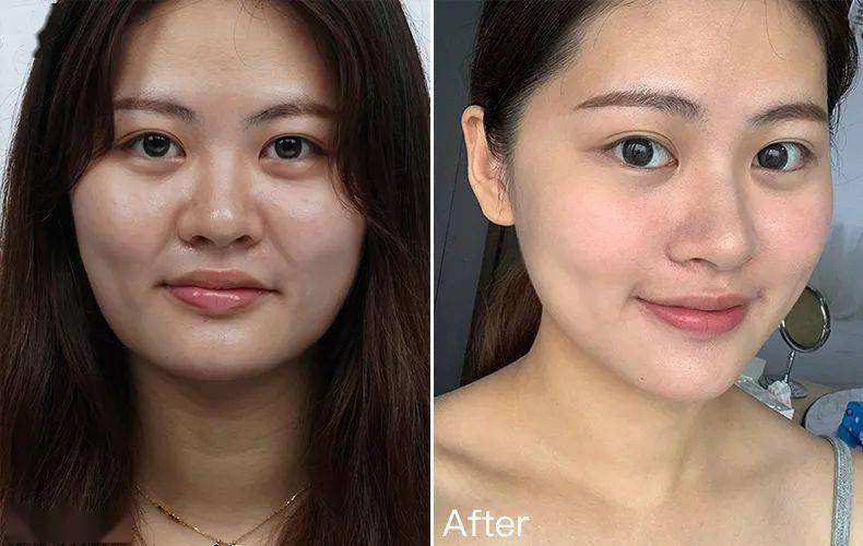 网友|47岁阿姨直播，“法令纹”2分钟磨平！网友炸锅：神仙操作！