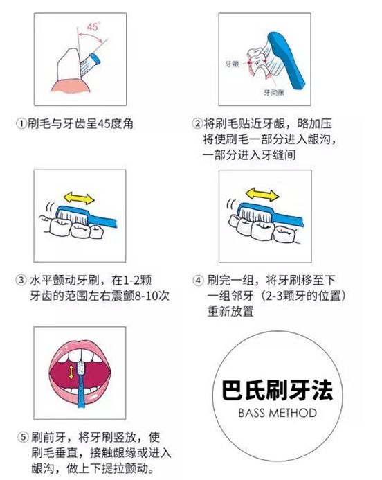 bass刷牙法挺管用,这是一种水平颤动法.