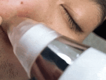 鼻子|米粒大的黑头，瞬间吸出，整个鼻子新生了！