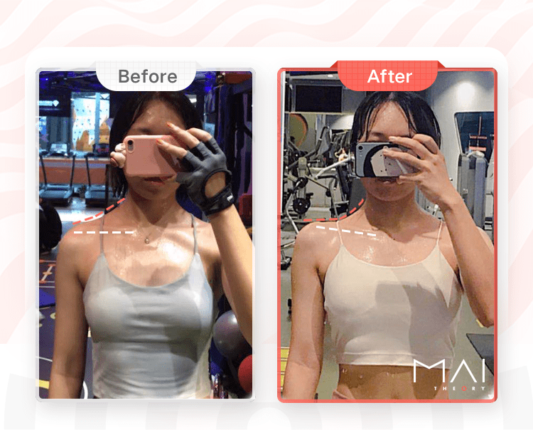 如何拥有直角肩锁骨 91c3a26709e64ac6a3c76e349ac2fac1.png