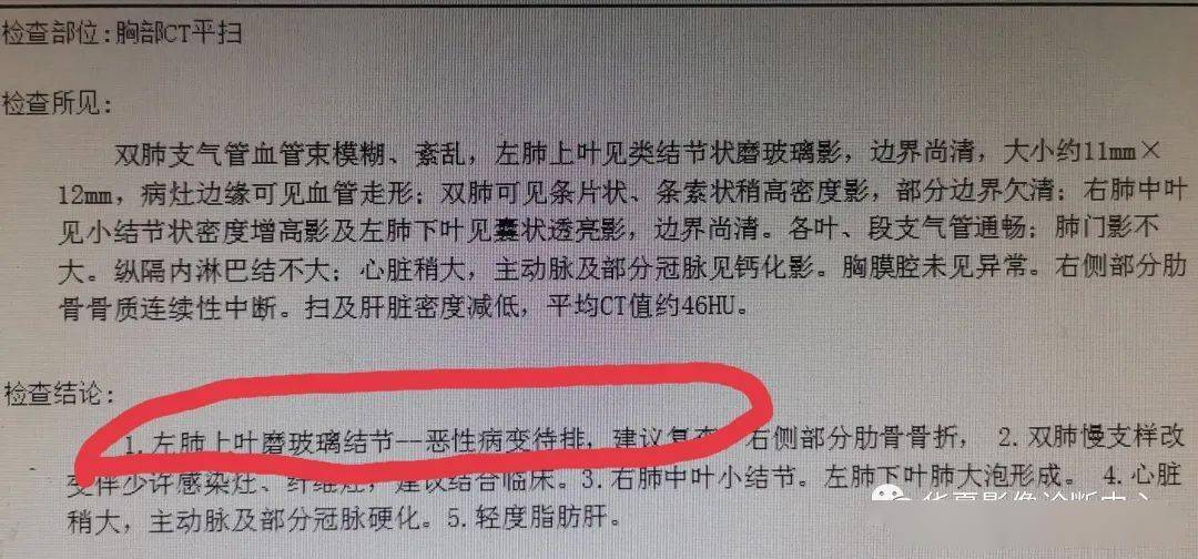 结论中的肺结节,建议随访结论中的磨玻璃密度影,一般良性居多返回搜狐