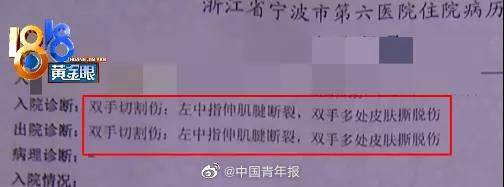 小张|但如何预防钢化玻璃爆裂更重要...百万网友帮“小张”维权