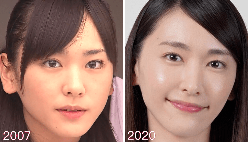 眼睛|32岁“国民老婆”喜当妈？！冻龄“眼”技完虐21岁女儿，做好这一步，真得会显年轻！