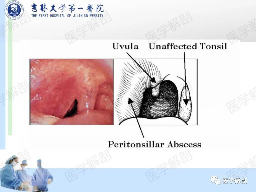 高清收藏咽部解剖