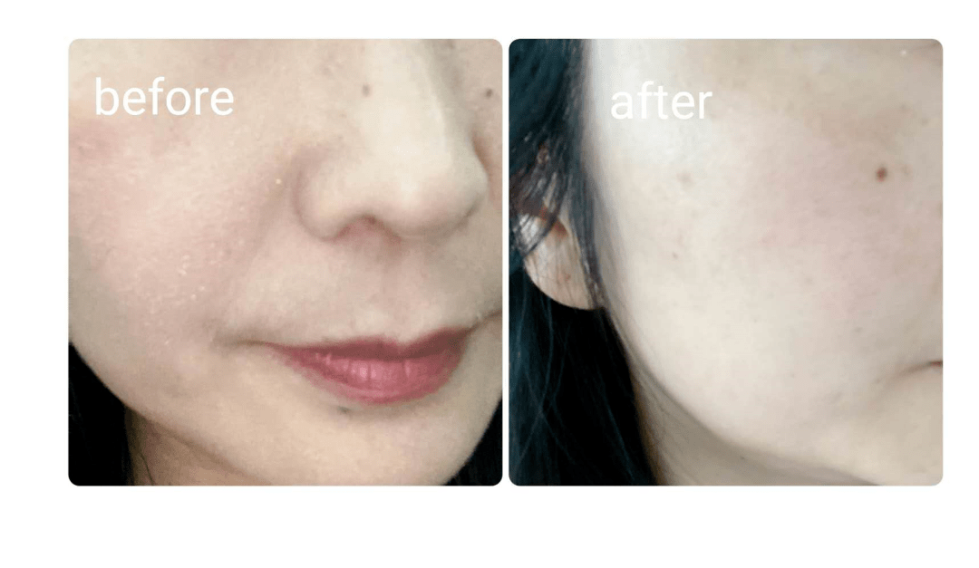 肌肤|买600送600丨3天拯救我的爆皮脸，居然还是梦露最爱，奥伦纳素爆款神价，一定锁住它