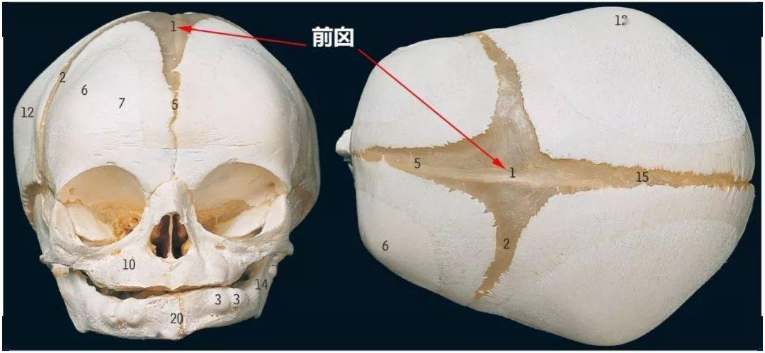 该点恰是距状沟的最远端,非常恒定.枕后点向上2-4cm即为人字点,向