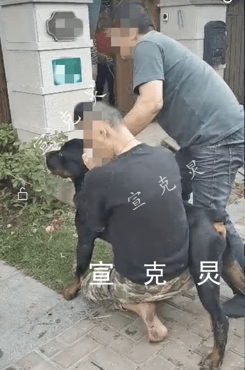 又是烈犬伤人上海一女子在小区内被烈性犬咬伤大腿更可气的是这只狗不