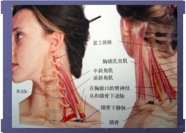 颈项部肌肉基础解剖——起止点及作用