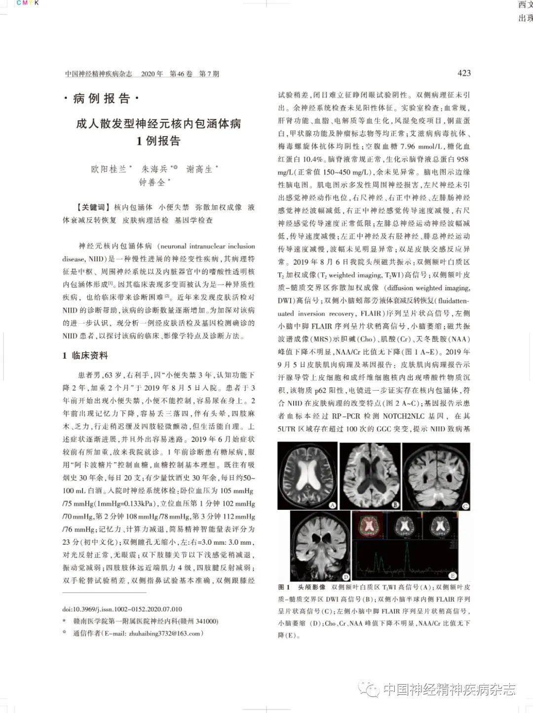 病例报告|成人散发型神经元核内包涵体病1例报告