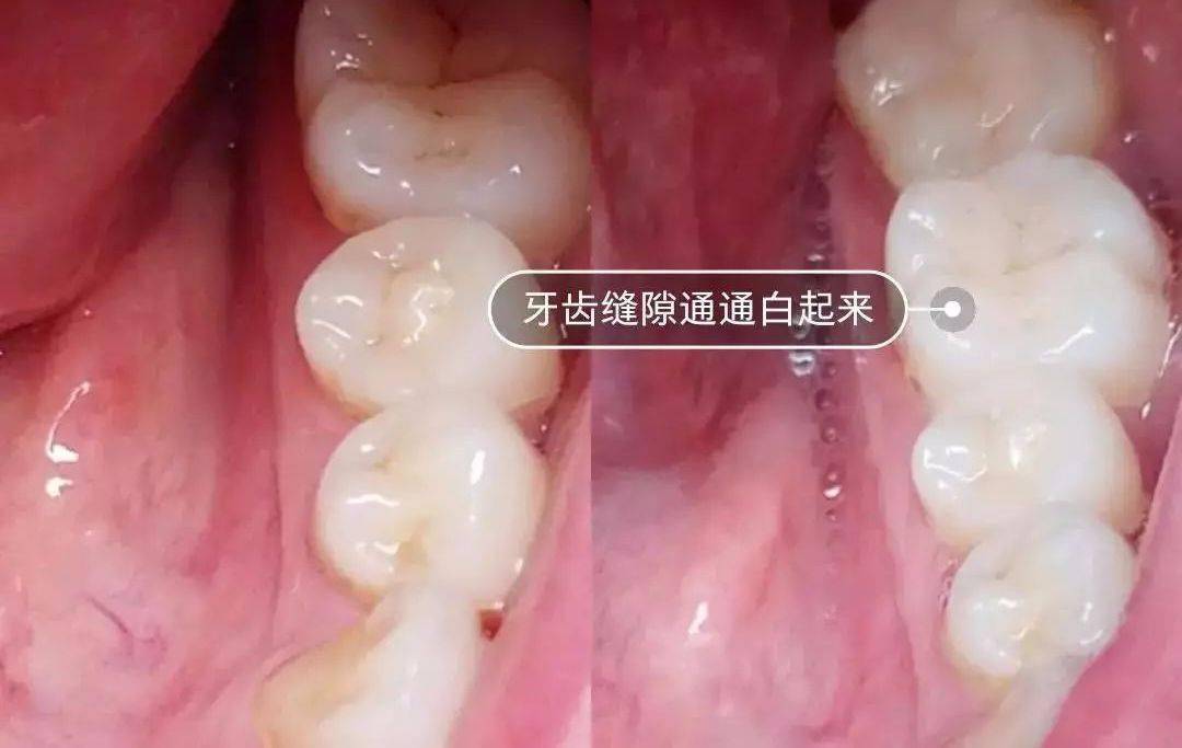 口腔|不到60元的电动牙刷，用起来竟然不输百元大牌！2分钟清洁整个口腔，性价比逆天！