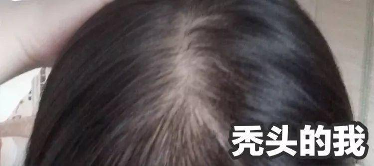 洗头|拯救细软塌,一喷一揉,头发随意蓬!