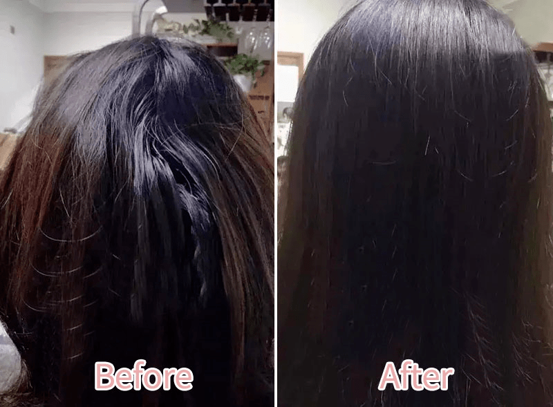 头发|头皮发痒，出油，还掉发？原来是你的洗发水没选好...