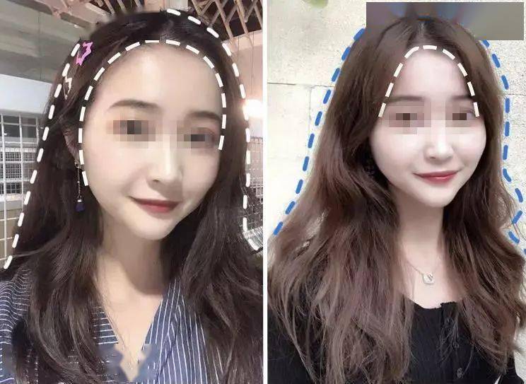 头发|头皮发痒，出油，还掉发？原来是你的洗发水没选好...