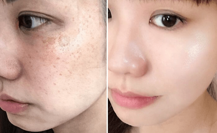 女人|如果你正长“色斑”,试试这个新方法,惊喜到让你尖叫!