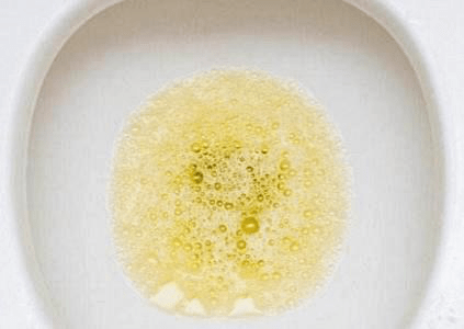 患者|【浙一全科﹒科普】 关于肾病？肾虚？那些事