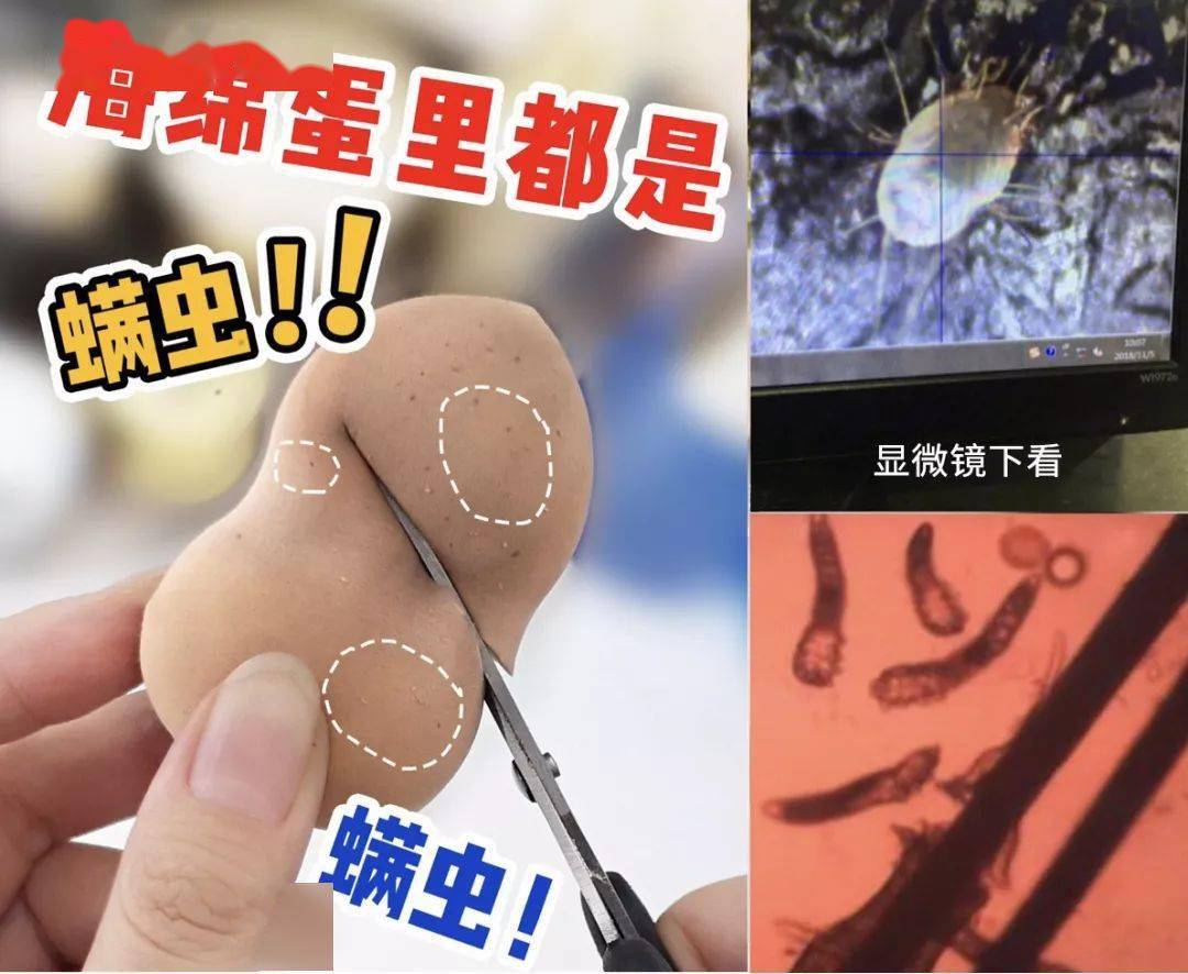 氨基酸|拒绝“螨虫脸”，5秒揉一揉，螨虫全出来了，痘痘黑头全没了！