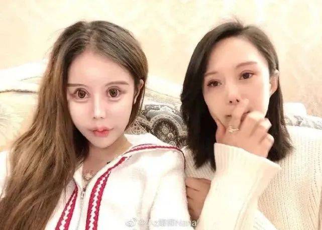 双眼皮|“我花了100万，把女儿整成了残废”：暑假整容风潮后，有20万女孩正在消失……