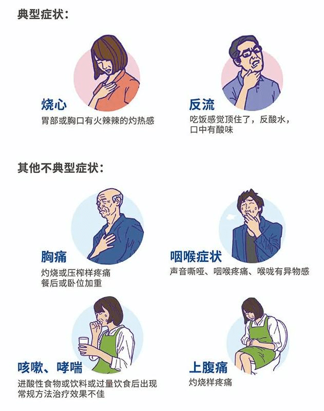 当胃酸反流进入咽喉,可能会引起声音嘶哑,咽喉疼痛,咽喉异物感.