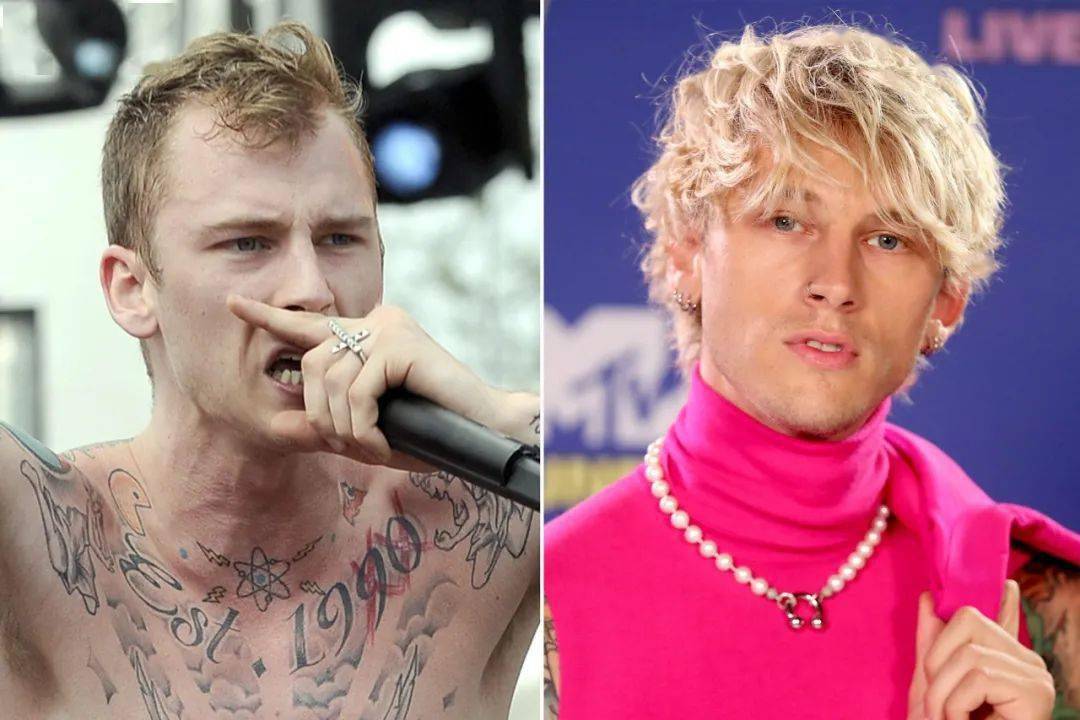 天啊,machine gun kelly 居然做过植发!