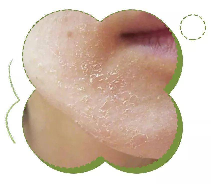 女人|懂得往脸上抹油的女人，还打个P玻尿酸！