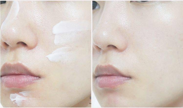 女人|懂得往脸上抹油的女人，还打个P玻尿酸！