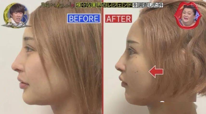 妹子|霓虹妹子整容上百次＂走上人生巅峰＂，以后还想整成桥本环奈…