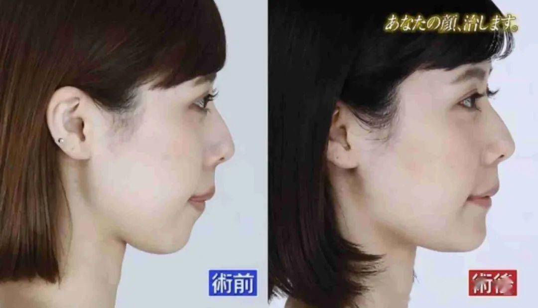 嘴唇|听说80%的人都在为这个颜值bug苦恼