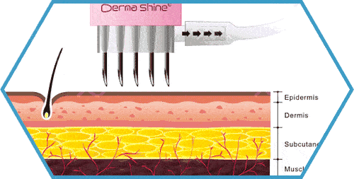 野心|钟楚曦素颜生图流出，她的野心也太大了...