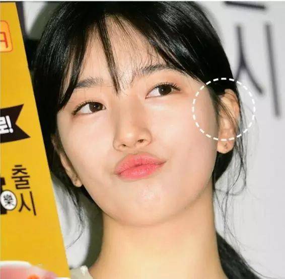 脸型|不整容也可以改变脸型？守住发际线就够了！