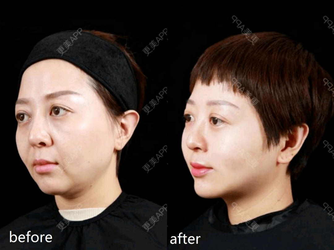 野心|钟楚曦素颜生图流出，她的野心也太大了...