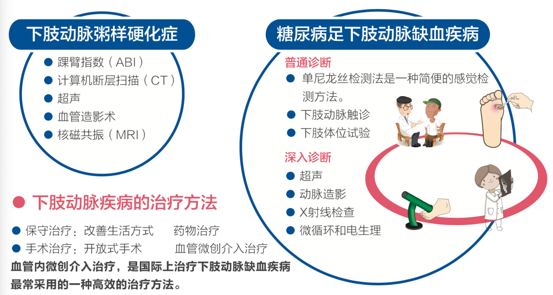 广安门|【广医时讯】广安门医院举办“周围血管疾病义诊宣传日”系列活动