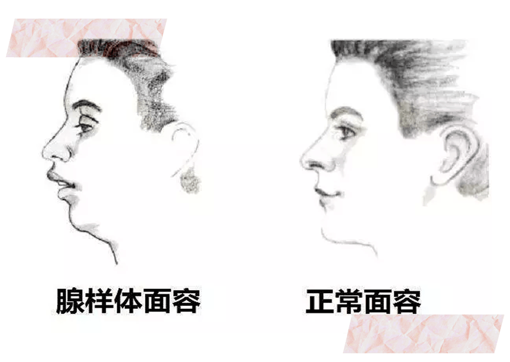 女生|为什么现在的女生，越长大越丑？