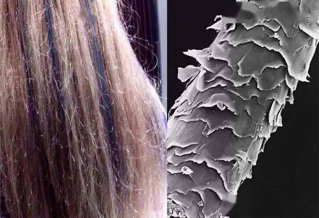 宝藏|头发一把把掉？这个土耳其宝藏固发神器，竟然一步搞定防脱、控油、去屑！