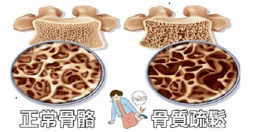 43ca83f60b694f21aacb00ab26d0601d.png