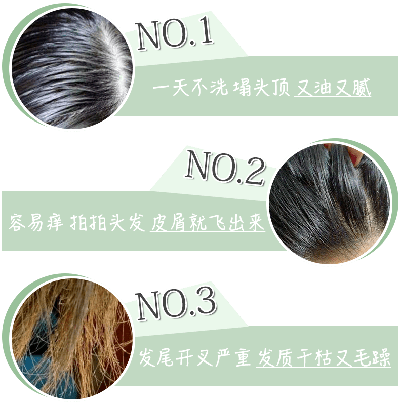 什么|连头发都快拼没了，你拿什么安身立命？