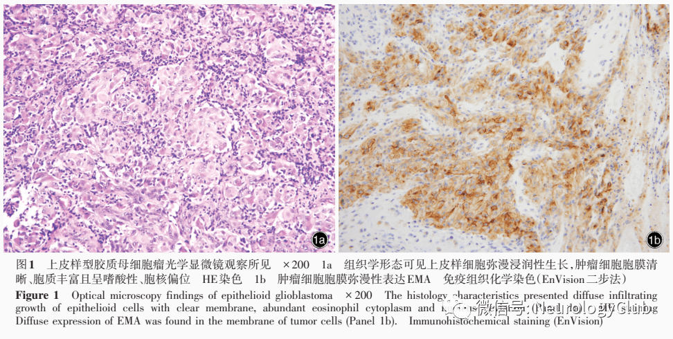 进行重新分类,并引入根据分子遗传学定义的肿瘤实体;对室管膜瘤引入1