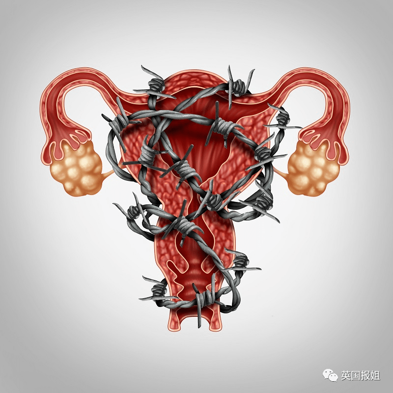 痛经痛到想自杀？上亿女性患有这种病却被骂矫情