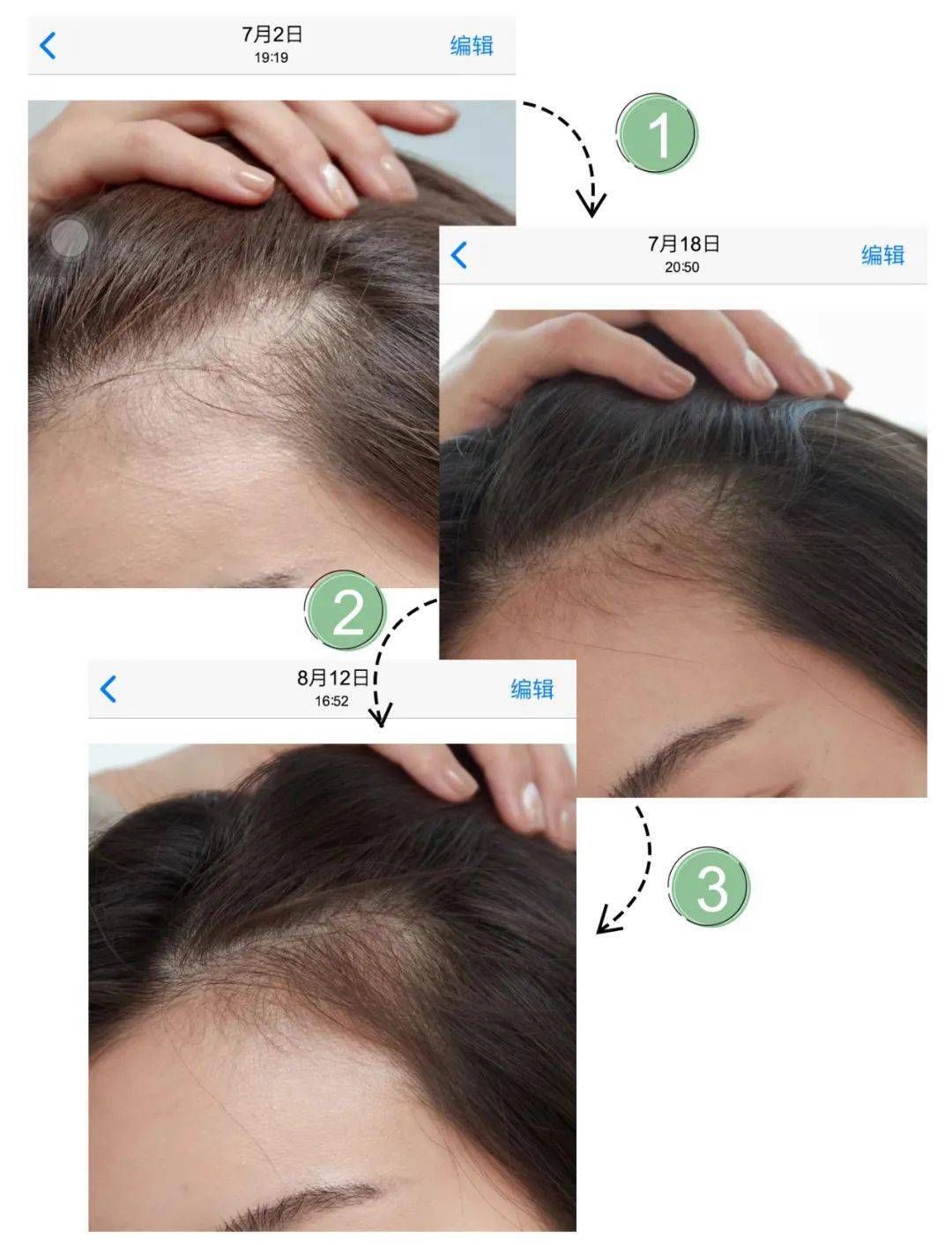 什么|连头发都快拼没了，你拿什么安身立命？