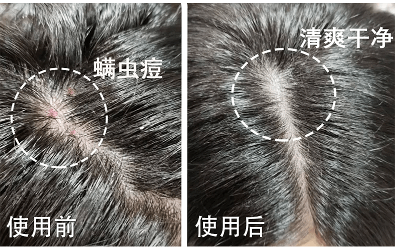 什么|连头发都快拼没了，你拿什么安身立命？