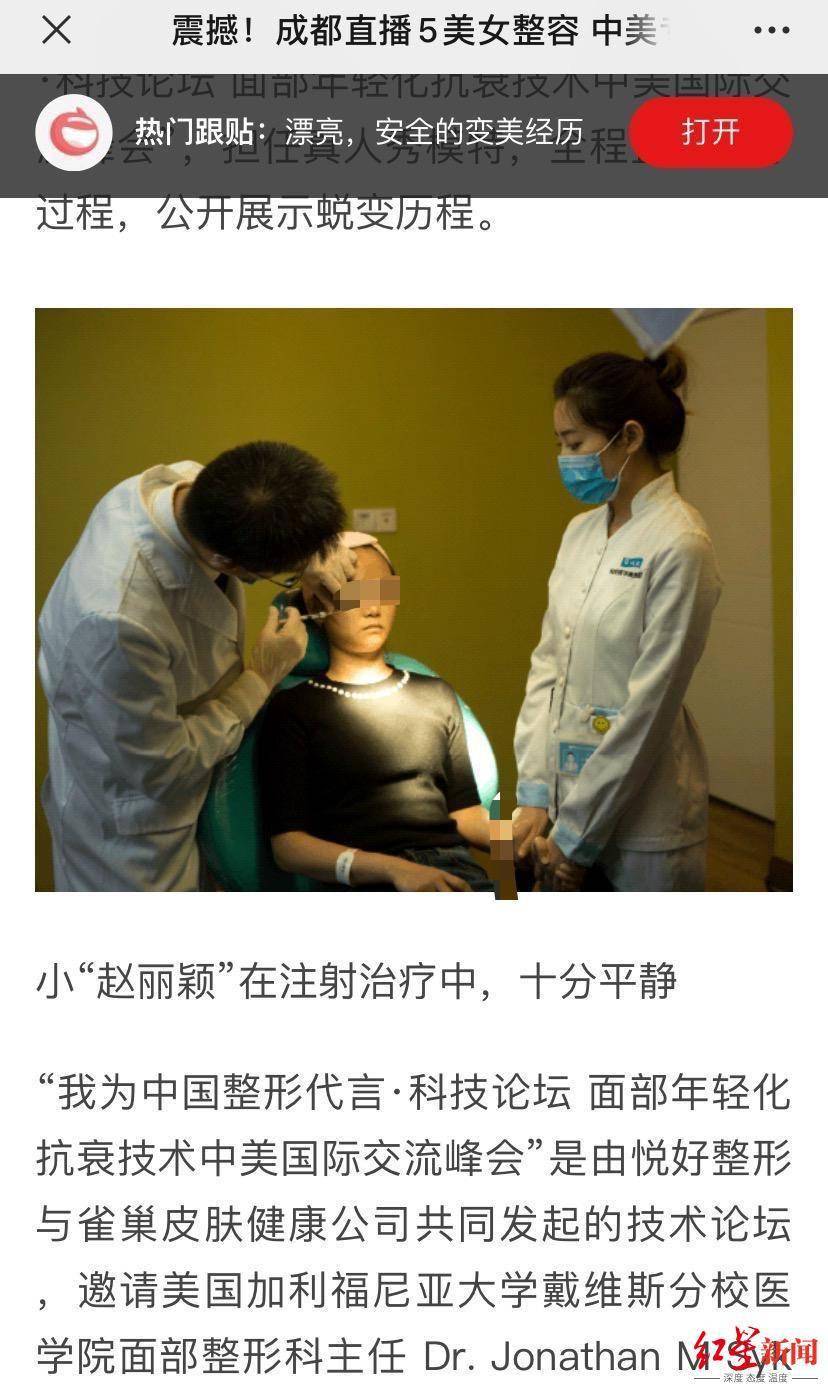 恒达官网整形悲剧:“成都赵丽颖”没当成,鼻子还变形 院方:手术确实出了问题 (图6) 恒达官网整形悲剧:“成都赵丽颖”没当成,鼻子还变形 院方:手术确实出了问题 (图6)
