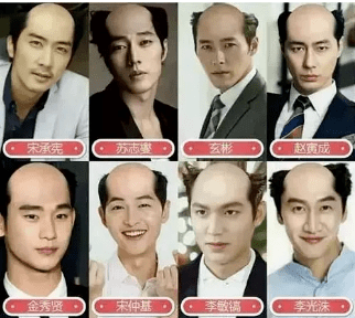 毛囊|流女星们的“狮子头”都是假象？录节目竟然当场掉下假发片，真相竟然是……