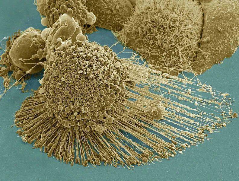 电子显微镜下的海拉细胞 图片来源:wikipedia