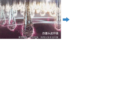 毛囊|流女星们的“狮子头”都是假象？录节目竟然当场掉下假发片，真相竟然是……