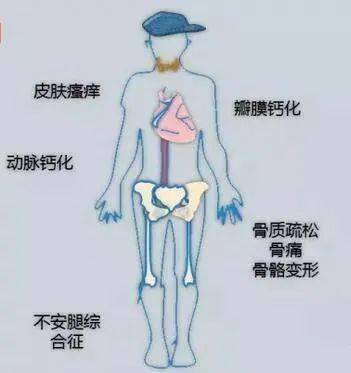 孩子|我不阻止孩子喝饮料，但这5类?被列入“黑名单”的，少给孩子喝吧！