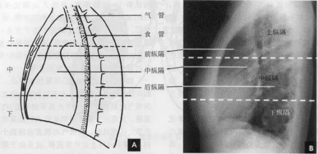 纵隔|读完此文，终于学会看胸片了