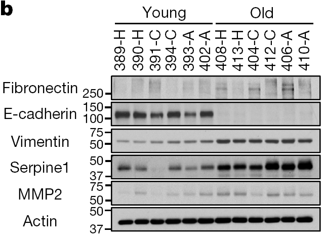 fibronectin-纤连蛋白,e-cadherin-钙粘蛋白,vimentin-波形蛋白