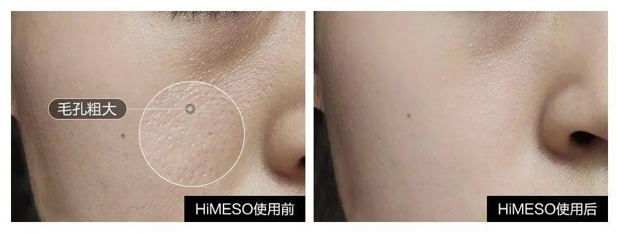 效果|她也太会玩了…